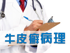 牛皮癣的得病原因有哪些